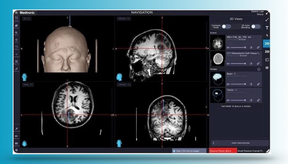 SKULL BASE SURGERY | Dr Diptiman Baliarsingh