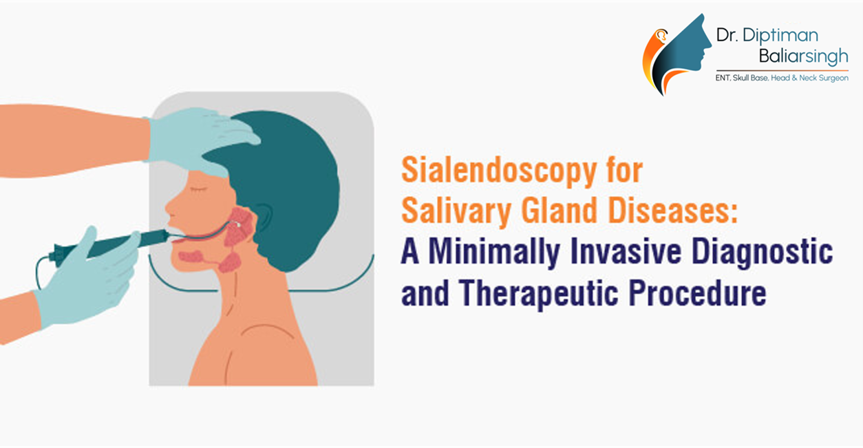 Sialendoscopy | Dr Diptiman Baliarsingh