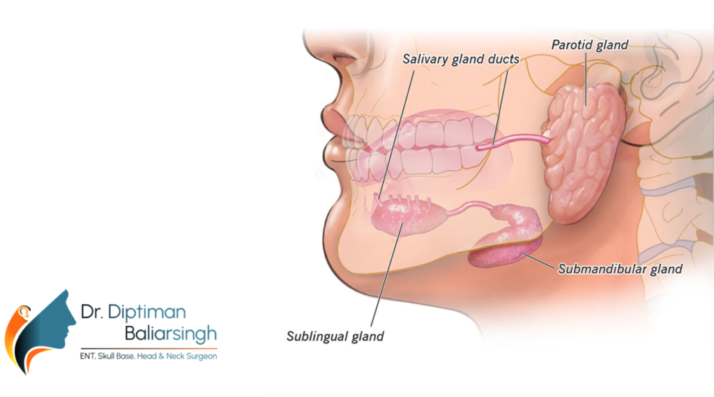 What is Sialendoscopy?