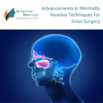 Advancements in Minimally Invasive Techniques for Sinus Surgery