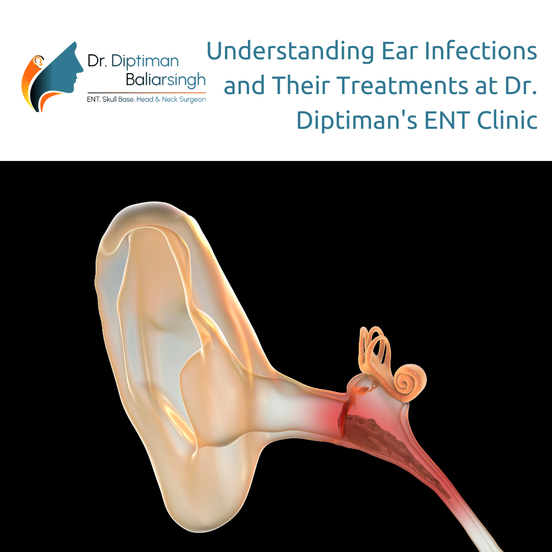 Understanding Ear Infections and Their Treatments at Dr. Diptiman's ENT Clinic