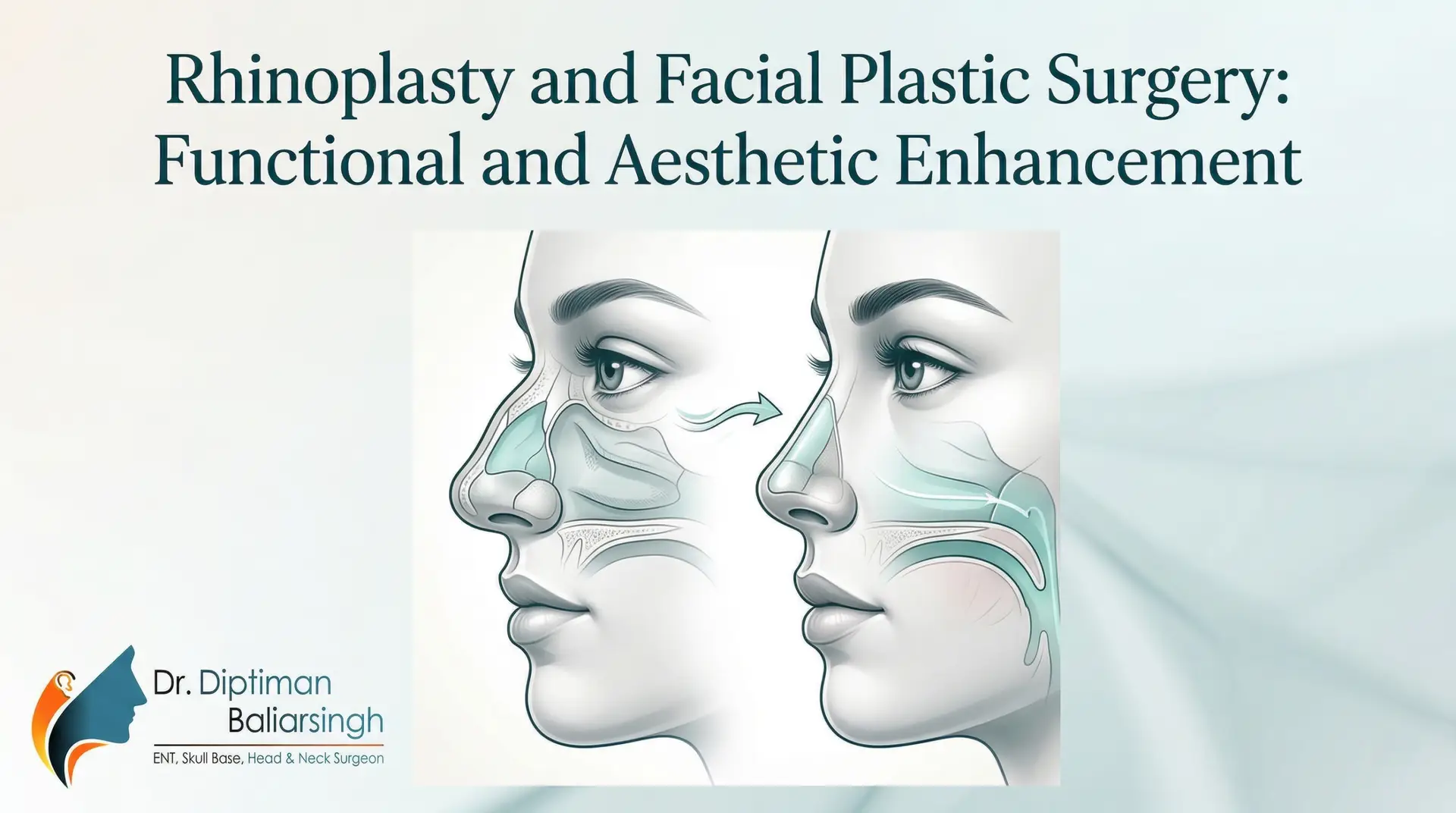 rhinoplasty surgery