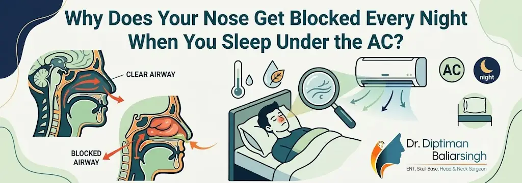 Infographic explaining why the nose gets blocked at night: head cross-sections show clear vs blocked airway near a sleeping person under an AC unit.